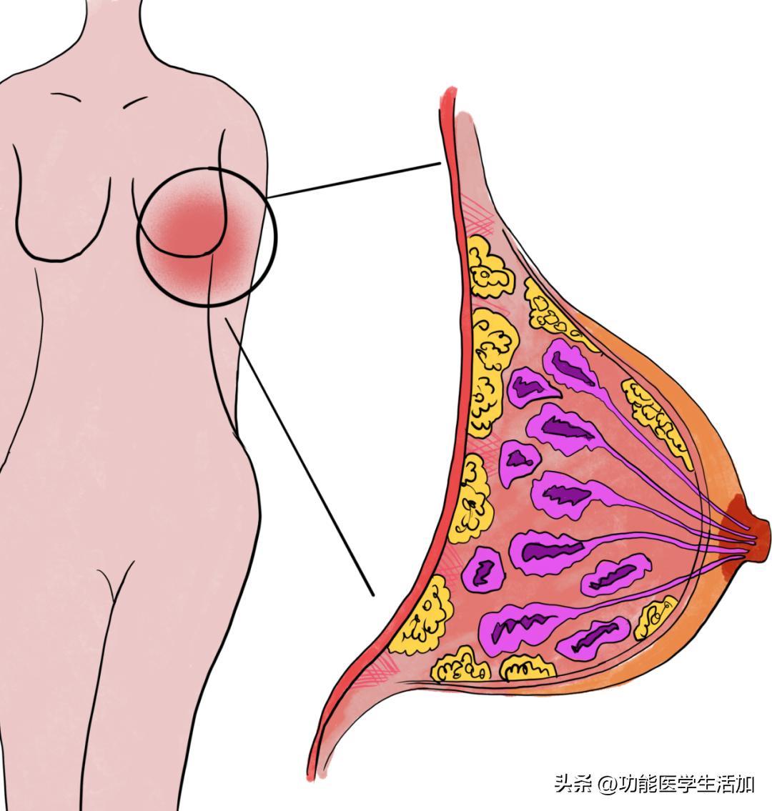 乳腺增生birads1类需要治疗吗,乳腺增生治疗费用大概多少