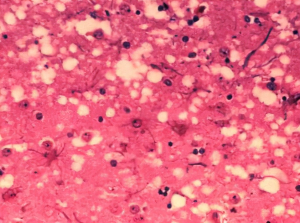 人类同类相食是怎么回事,人类基因有防止人吃人的吗