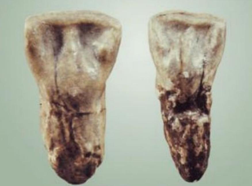 华夏子孙的3个印记：门牙、褶子和脚趾，与生俱来且无法抹去