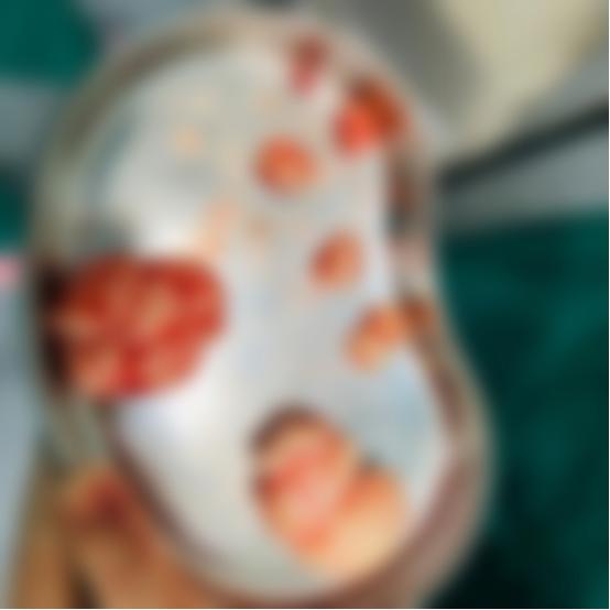 贫血是子宫肌瘤引起的吗,贫血有可能是胃出现问题吗