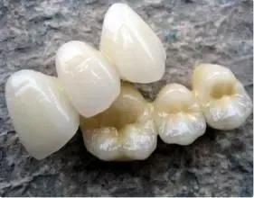 一分钟带你了解美牙,一分钟带你了解眼镜