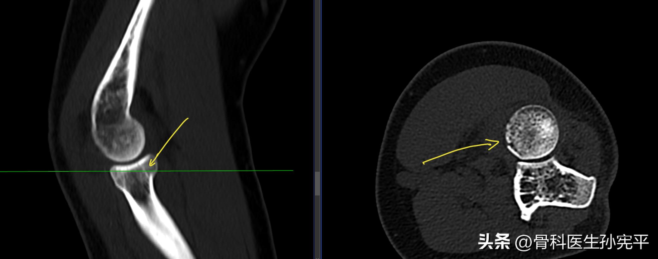 医学影像趣图,震撼的医学影像