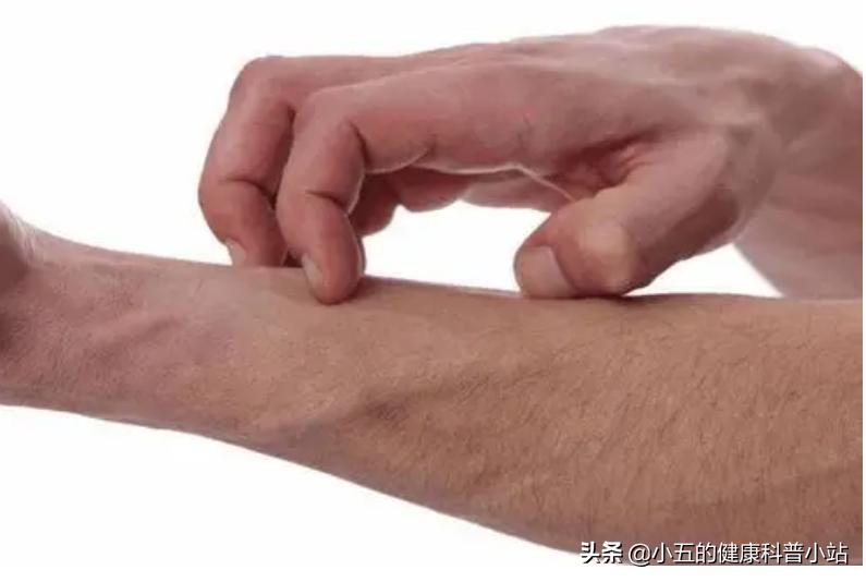 老年皮肤干燥引起的瘙痒怎么内调,老年皮肤瘙痒掉皮怎么治疗