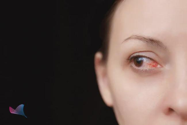 红霉素眼膏几日见效果,红霉素眼膏一般多少钱