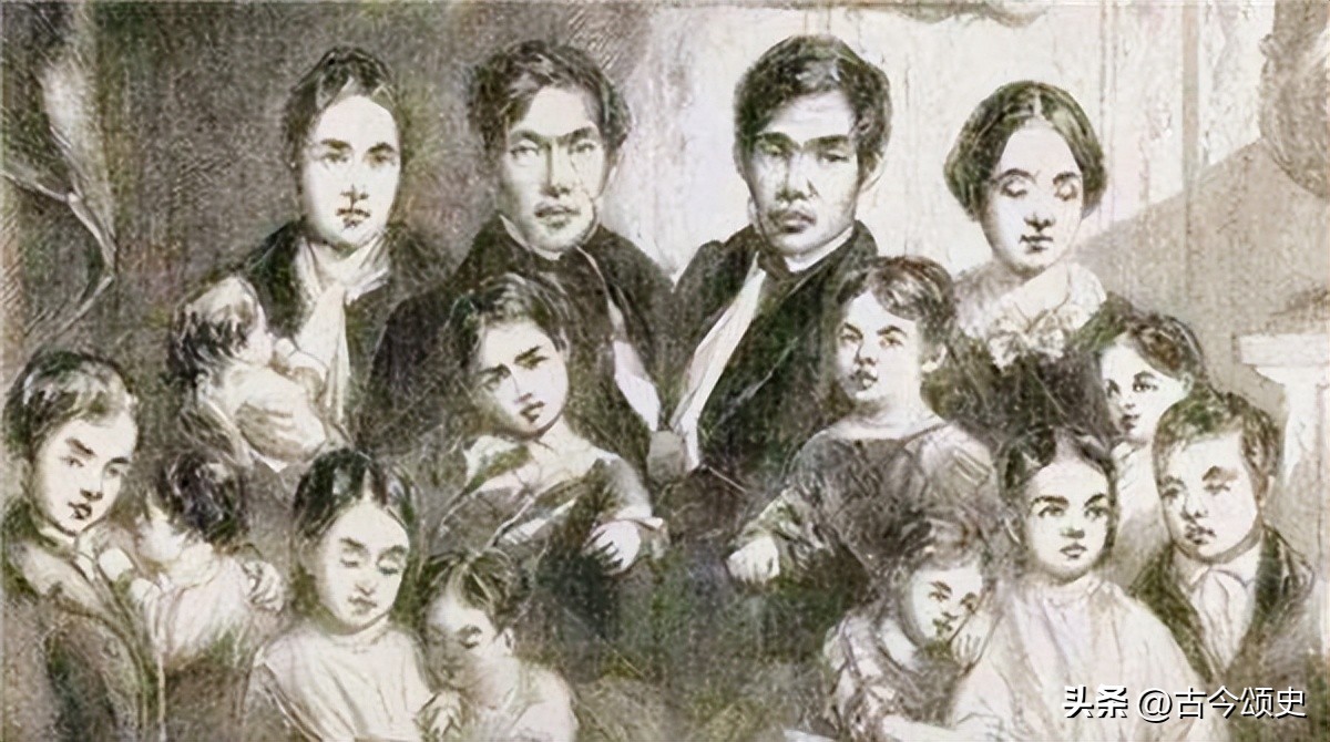 连体人结婚生子,连体人如何生子