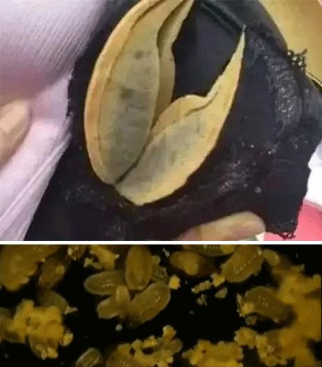 内衣去尿渍洗涤液是骗人的吗,内衣杀菌洗涤剂