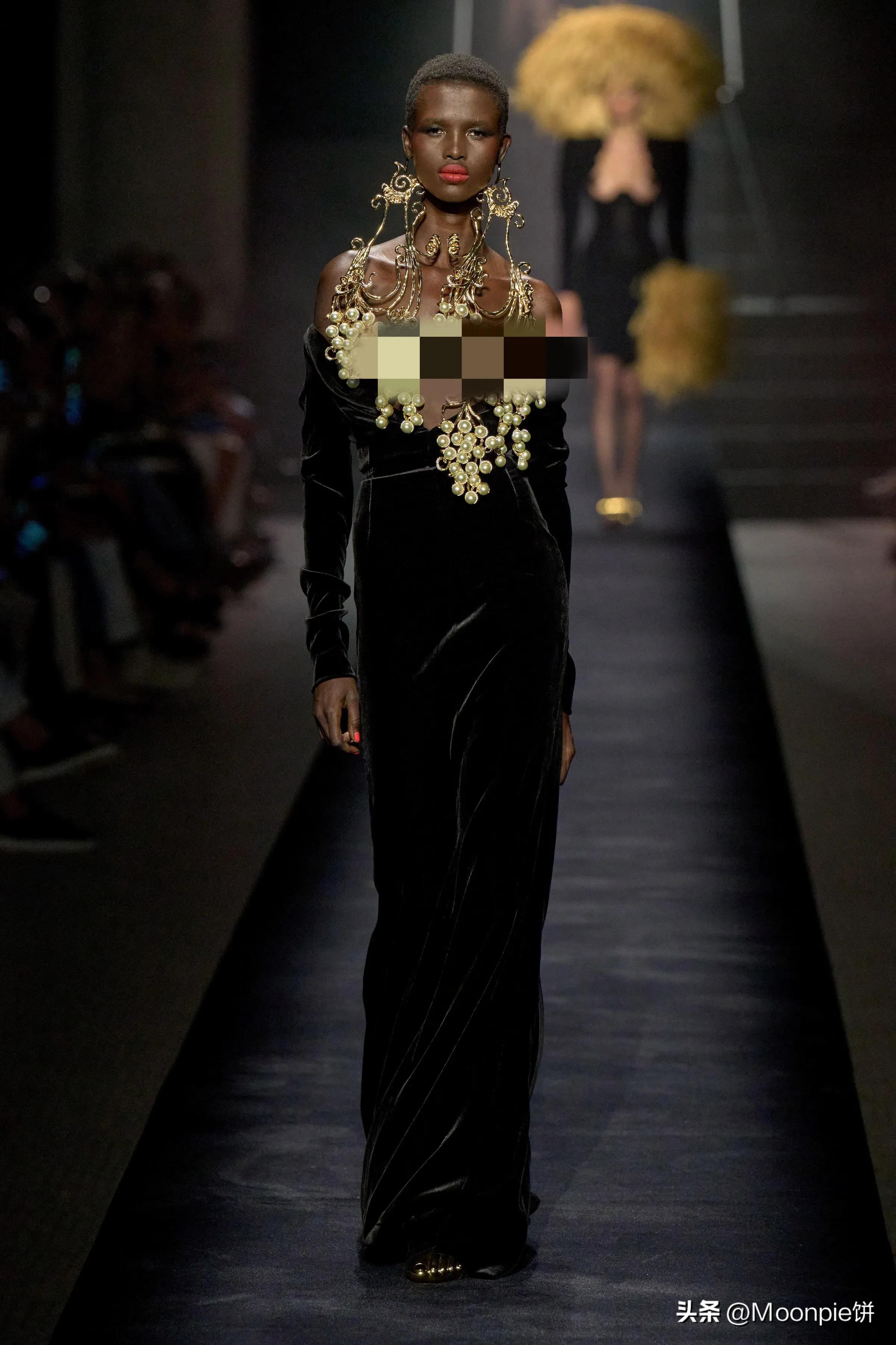 为什么胼胝体会缺失,schiaparelli水平