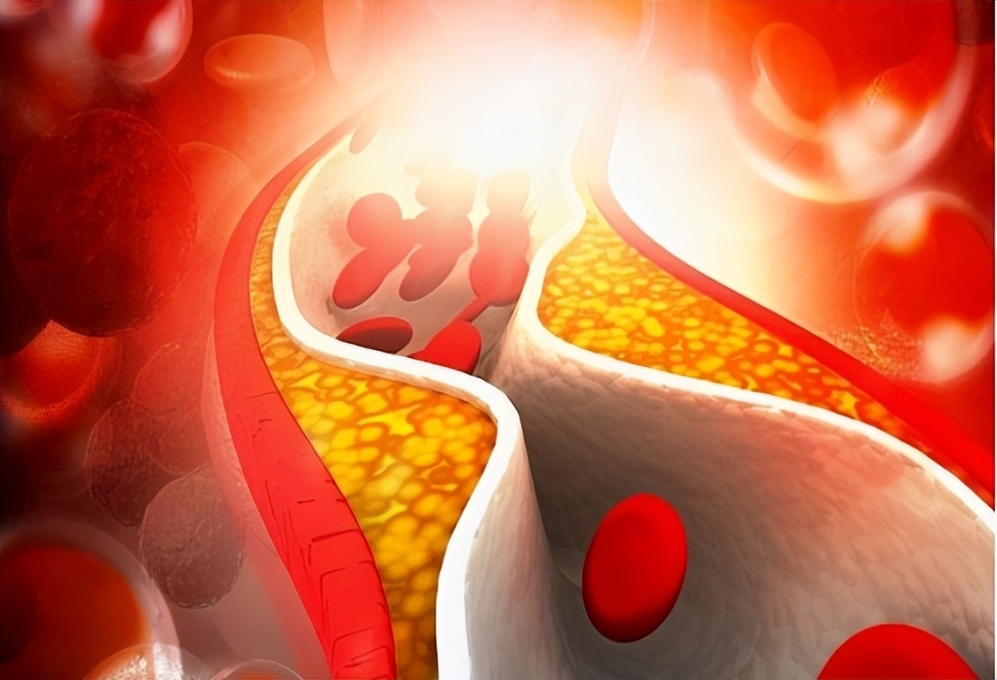 长期服用通心络麝香保心丸的好处,常吃麝香保心丸会便秘吗