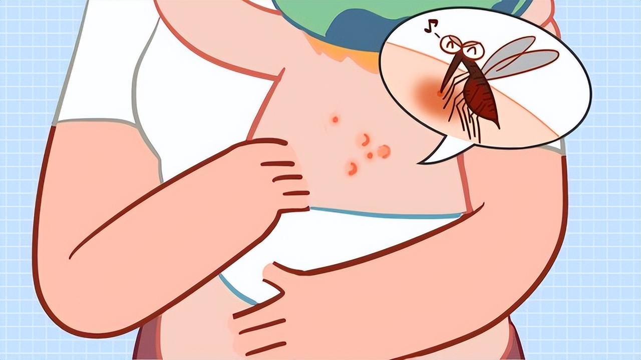 为什么被蚊虫咬了以后皮肤会起包,为什么被蚊虫咬了起泡了