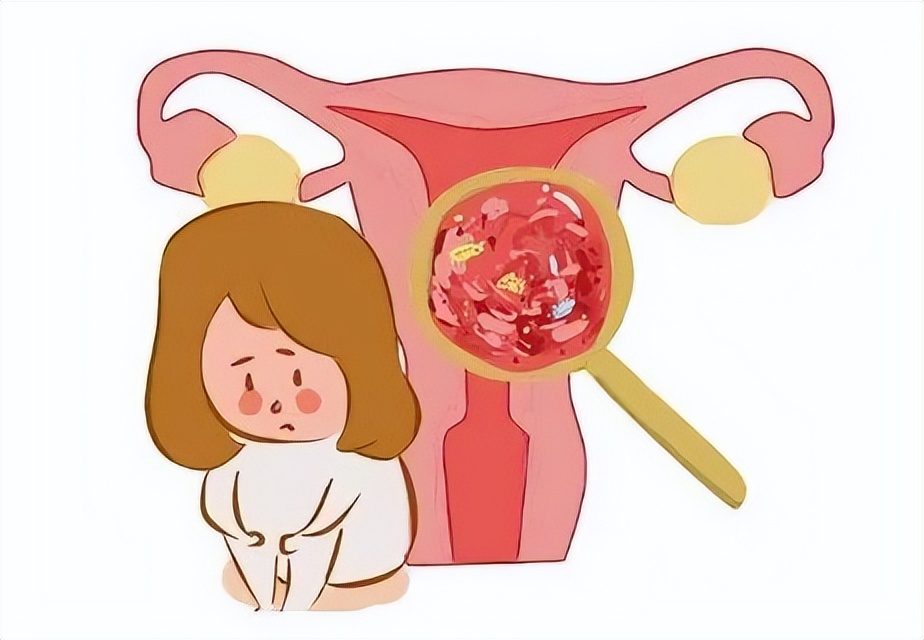 女生底裤发黄发硬怎么回事,女性裤头发黄是什么原因