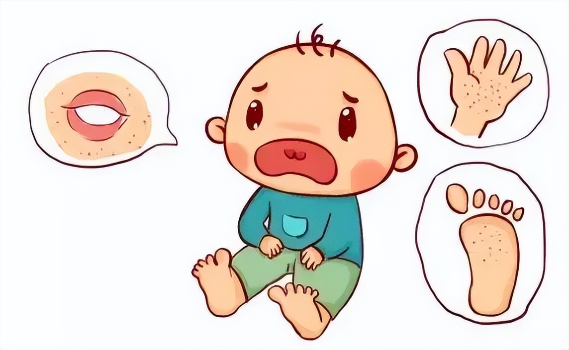 手足口病防治知识宣传手抄报,关于手足口病的知识以及防治