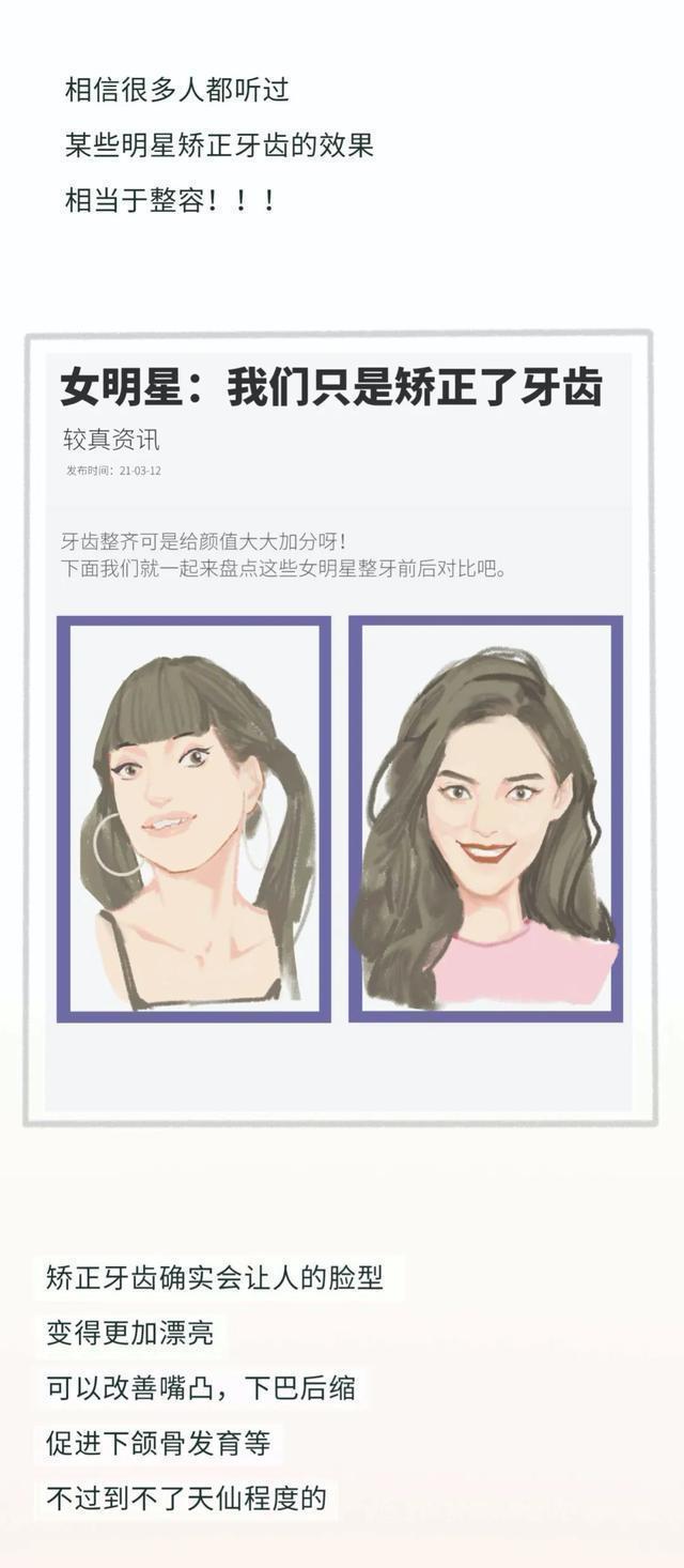 牙套矫正过程漫画,戴牙套是什么体验