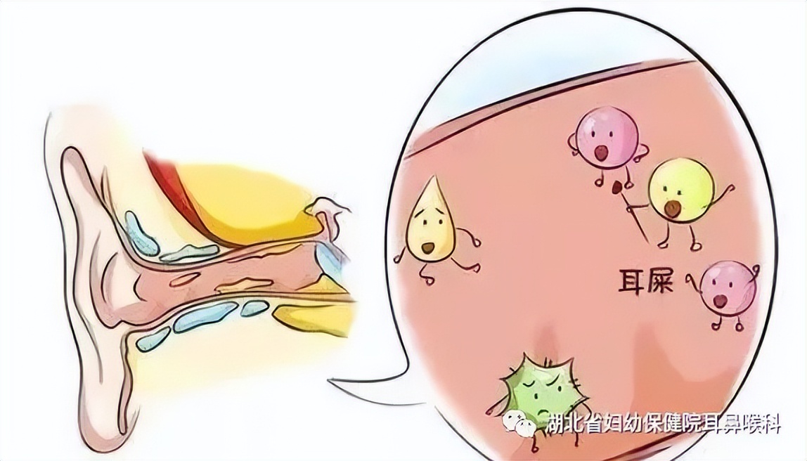 耳朵游泳进水了怎么办,游泳耳朵进水像堵了一层膜听不清