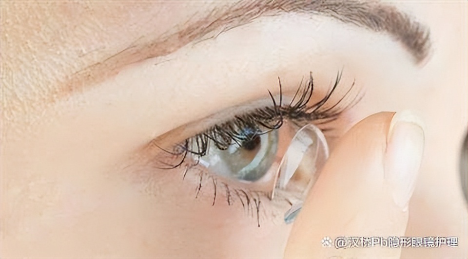 戴隐形眼镜需要补充叶黄素吗,隐形眼镜导致角膜上皮缺氧科普