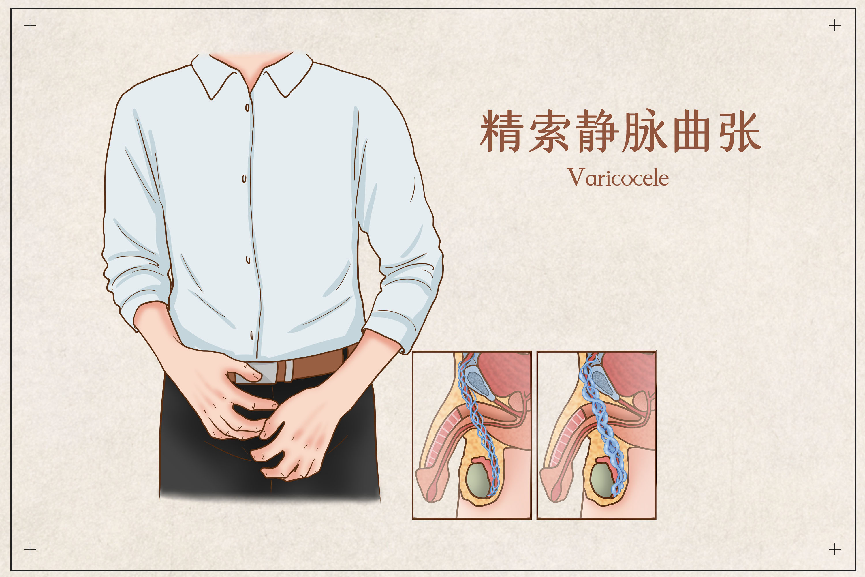重度弱精可以吃凯贝尔锌硒片吗,重度弱精可以做一代试管吗