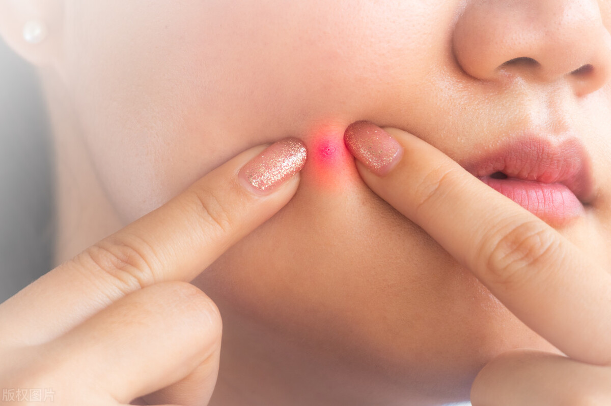 阳康后脸上长痘痘怎么办,阳康后脸上长痘痘是什么原因