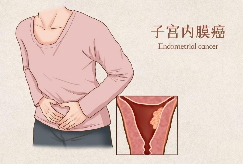 女人摘掉子宫后，和正常女性有什么区别？医生说出大实话