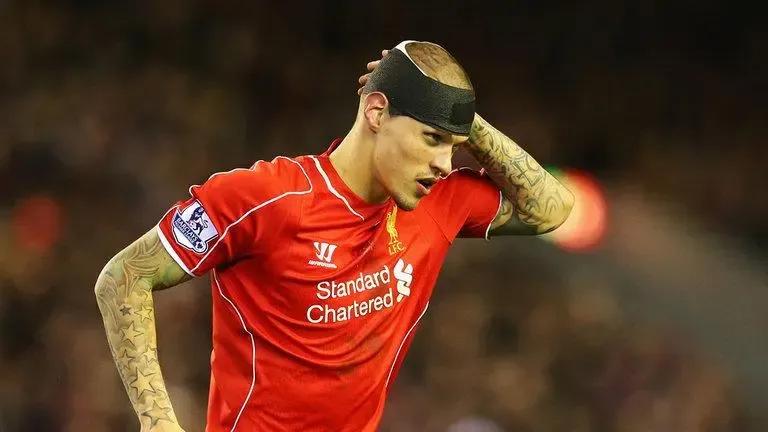 斯科特尔阿格尔利物浦,克洛普利物浦传奇队