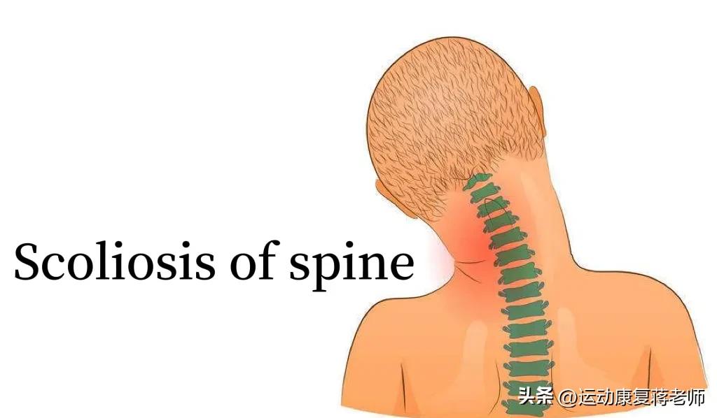 歪头斜脖子矫正方法,歪头歪脖怎么矫正