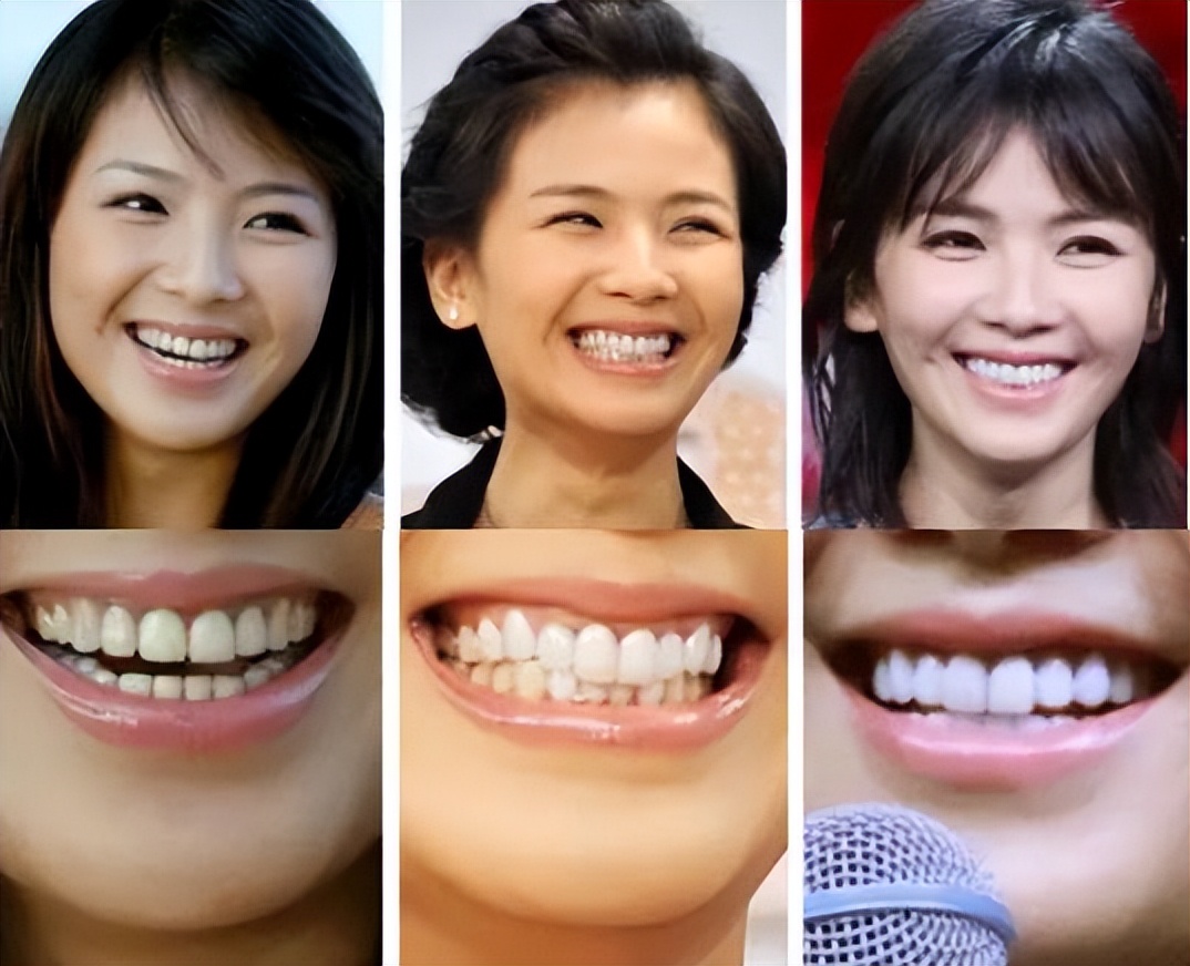 瘦到脸部凹陷到底好不好看,瘦到五官凹陷