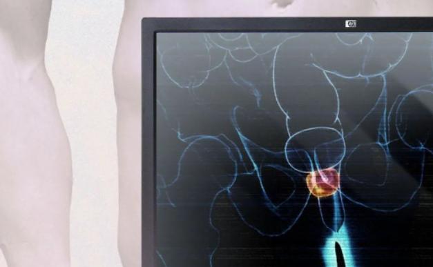 前列腺炎患者远离这4个错误行为,泌尿外科给男性的忠告