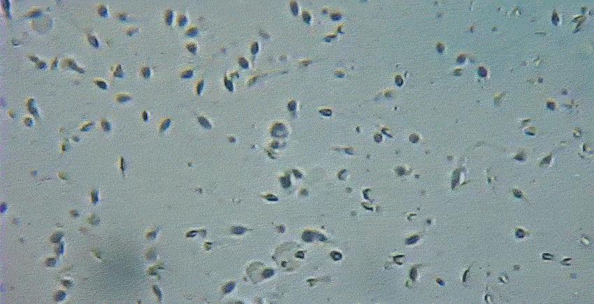 进入女性体内后，没成功“受精”的东西都去哪里了？既好笑又心疼