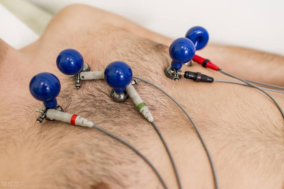 1个20元的检查，可以提前筛查心肌炎，是真是假？医生说出实情