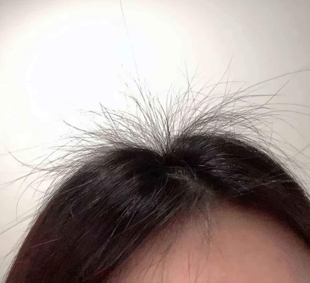 轻松解决脱发养出坚韧厚发,脱发严重这个防脱发妙招很好用