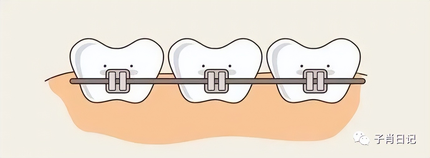 牙齿治疗算一般疾病么,牙齿烂个洞不能拖