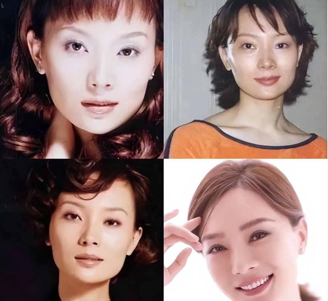 最近哪个明星割双眼皮前后对比,明星一般都做什么样的双眼皮