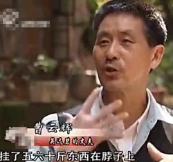 重庆一妇女肚子巨大,女子肚大如球竟是5颗肿瘤