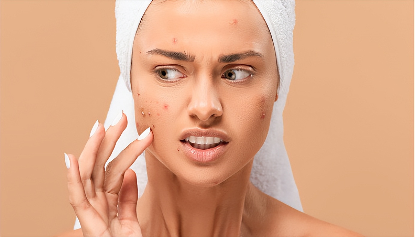 不同原因形成的青春痘，其治疗方式都一样吗？医生：女生不一样