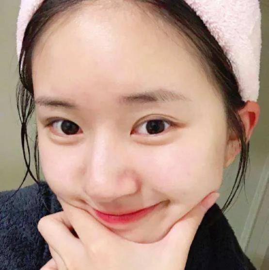 怎么保养嘴巴周围,嘴巴闭口怎么消除小妙招