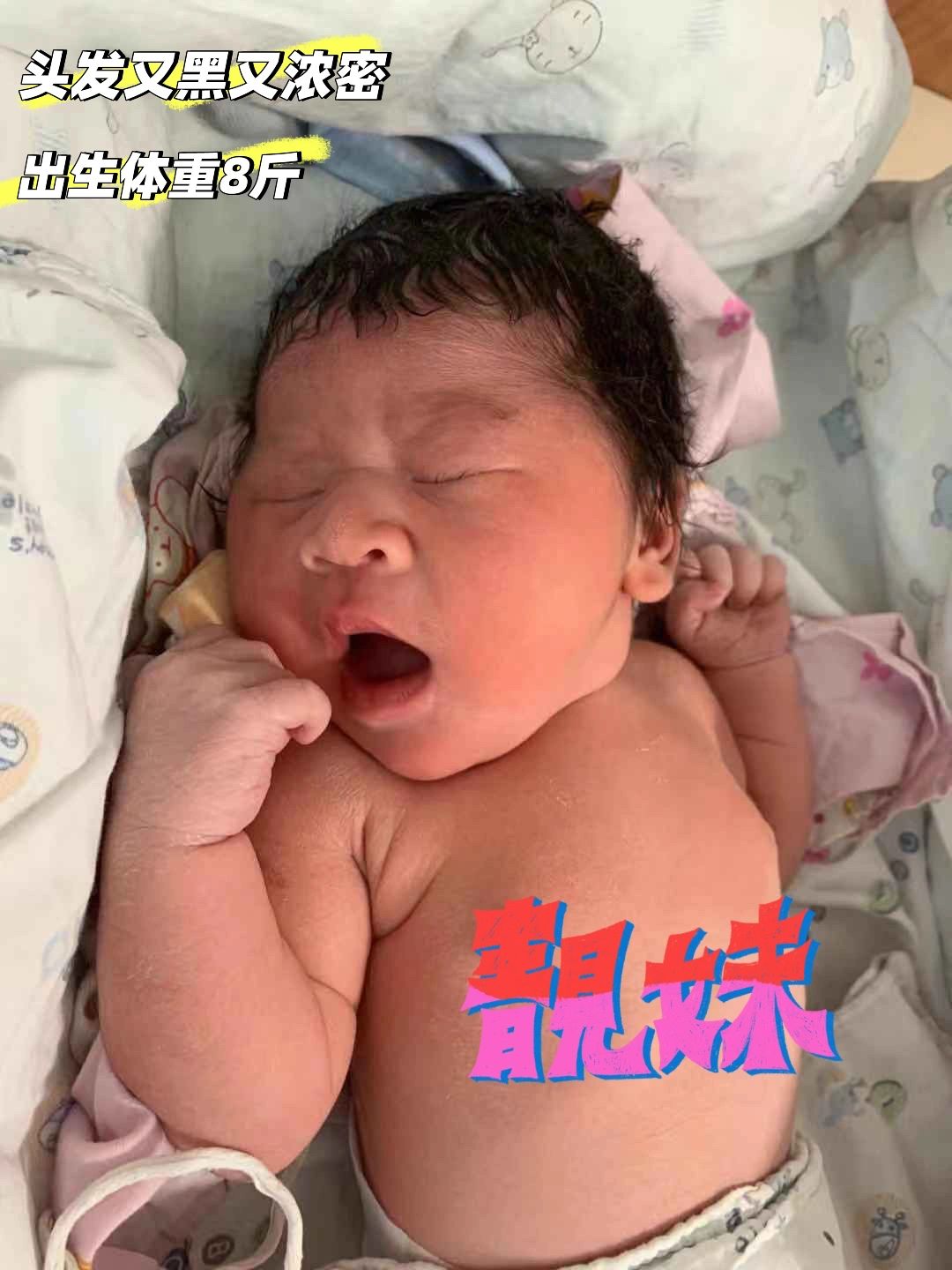 超快顺产｜无侧切无撕裂经验分享