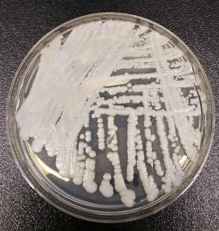 耳念珠菌与普通白色念珠菌有哪些不同？