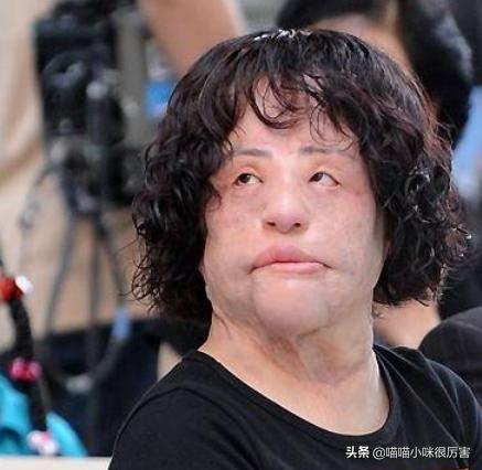 韩慧景整容故事,韩慧景第一次整容