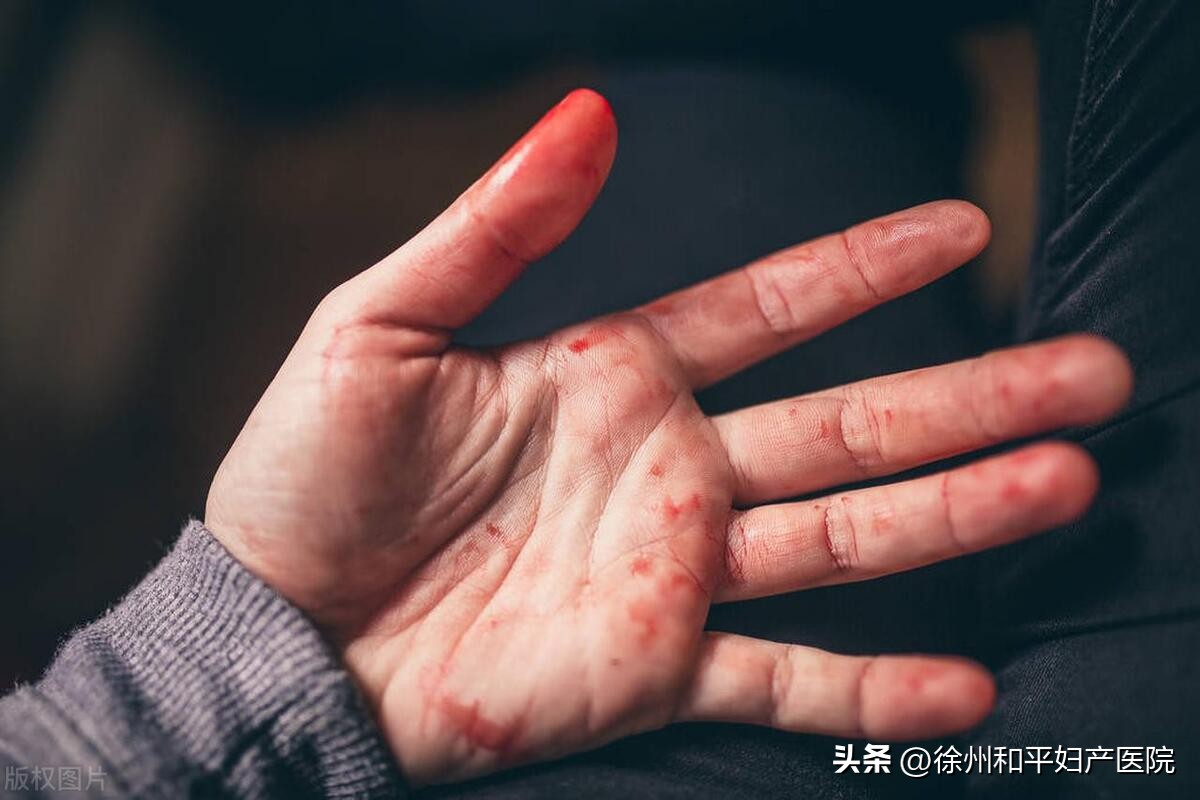 验孕棒两条杠是着床成功了吗,验孕棒早上两条杠晚上一条杠