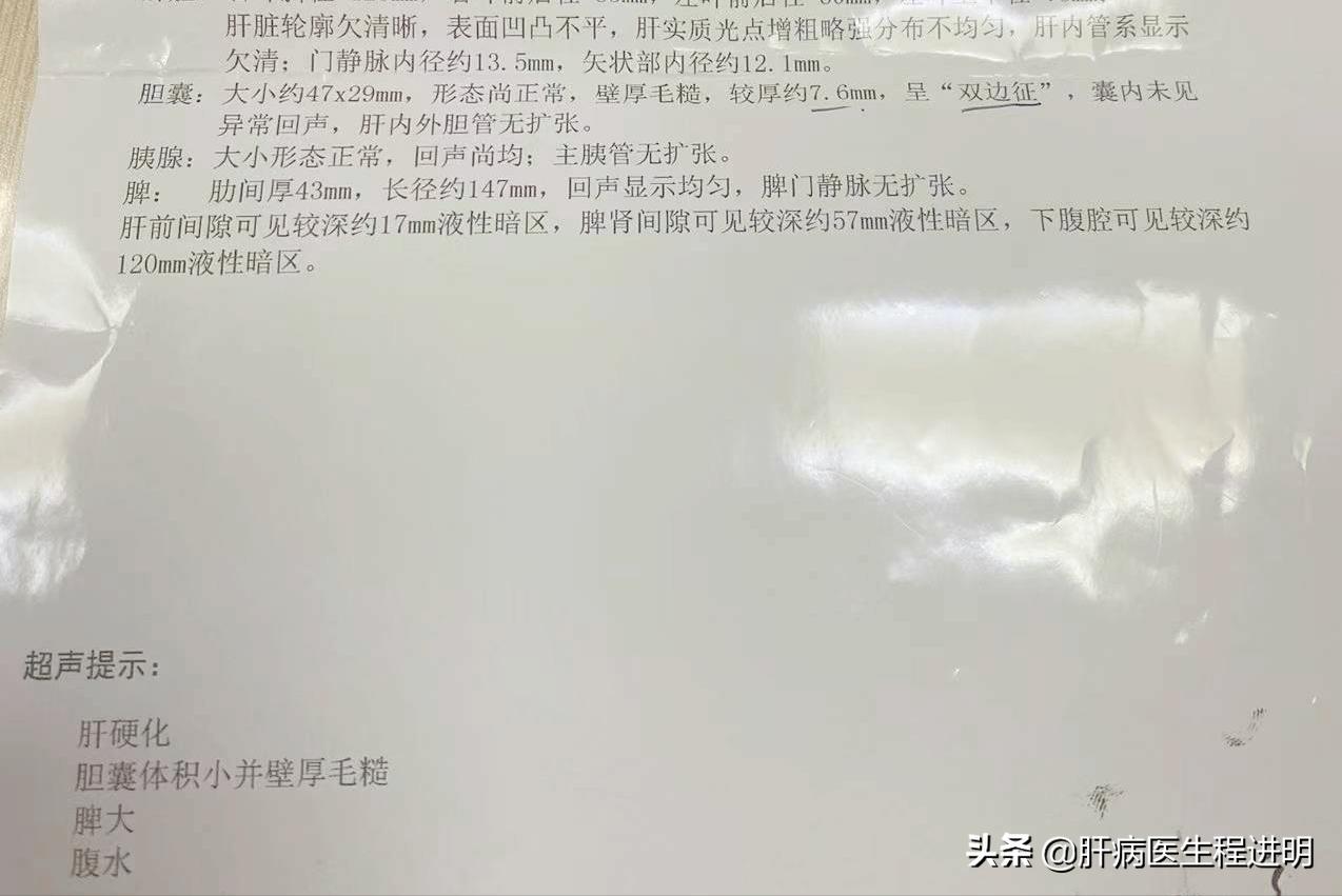 再重的肝病也有希望!最好的礼物就是康复