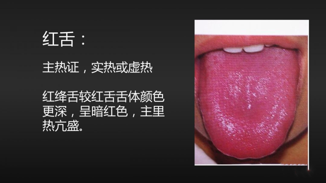 中医四诊中的正常舌象,中医看舌象准还是摸脉准