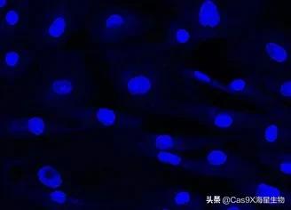 支原体的检测方法,支原体的检测方法常用