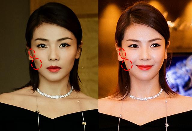 有颧骨的人怎么会显的好看,高颧骨是显老还是显年轻