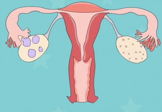 月经快离开的征兆,月经来临前两个小时的征兆