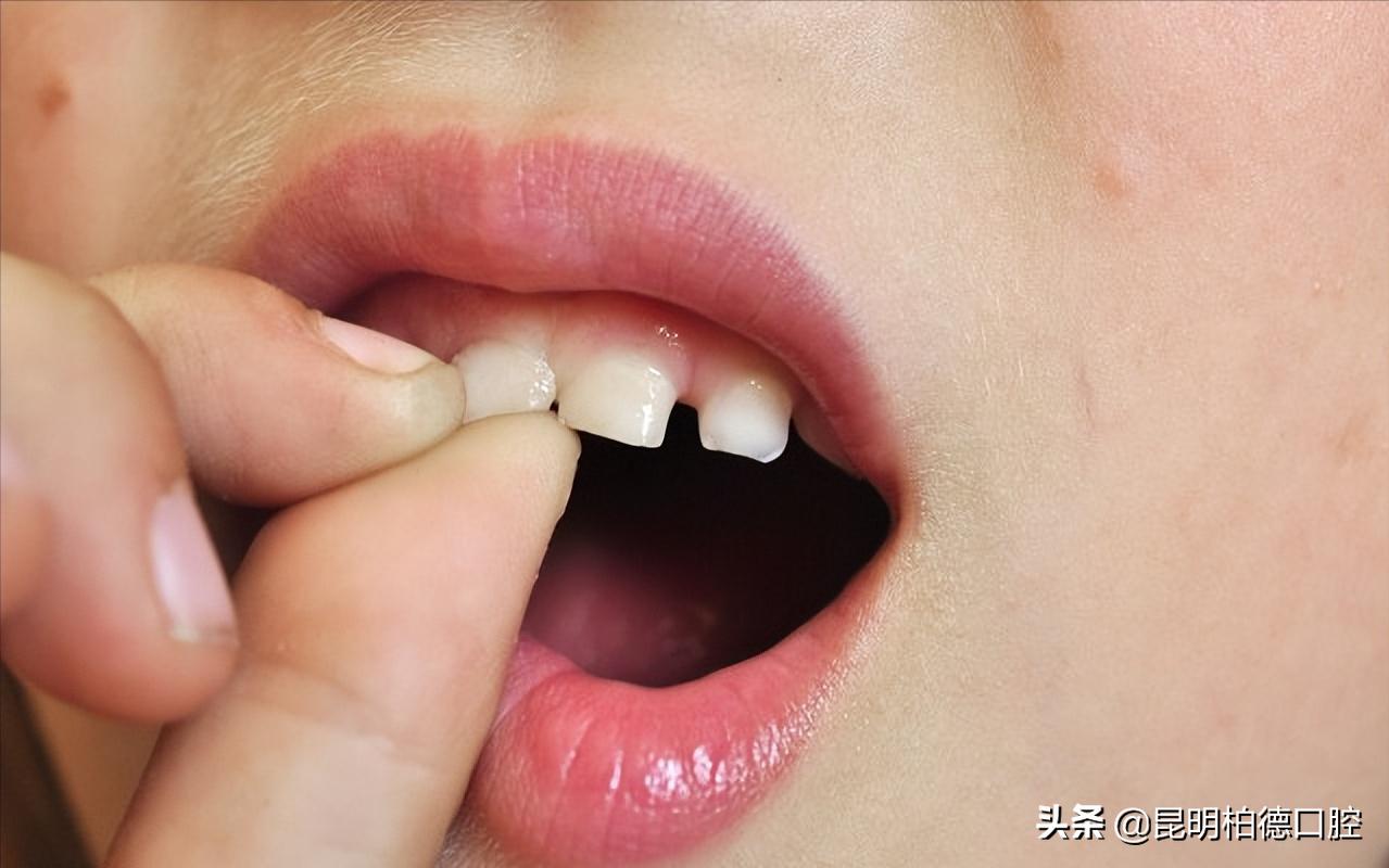 年轻人出现的牙齿松动怎么办,成年了下牙齿有一点点松动怎么办