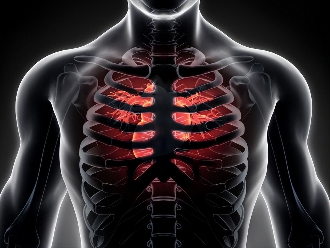 胸腔积液是属于重大疾病吗,胸腔积液一般是由什么原因导致的