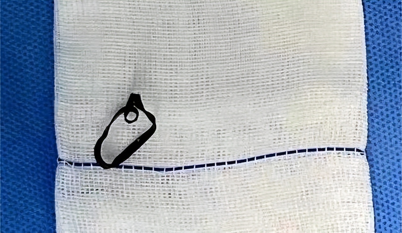 女童女裤有黄渍正常吗,女童裤上有血是怎么回事