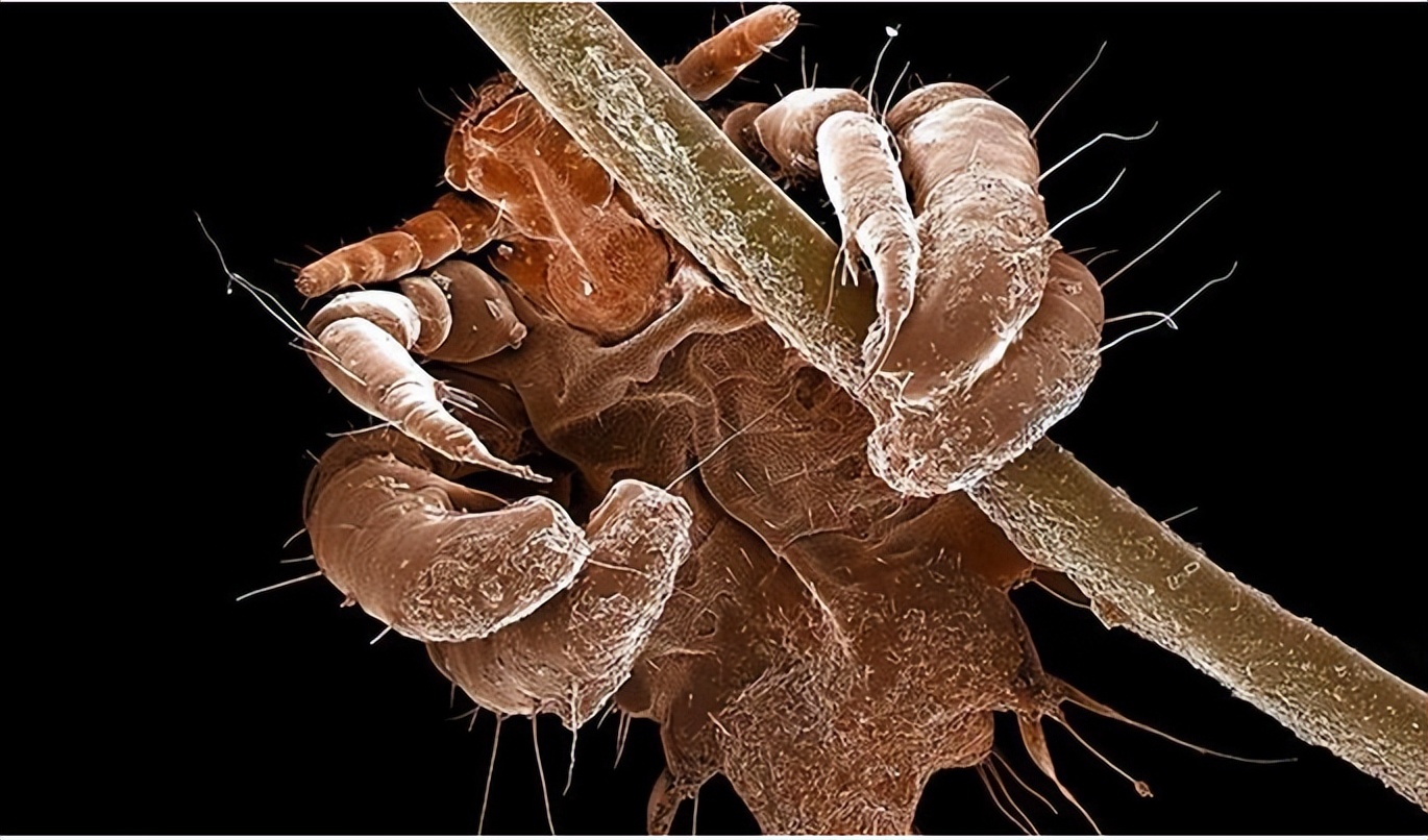 男子腹部痒,男性大量阴虱和虫卵