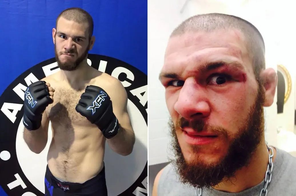 职业拳击手有没有被打死的,职业拳击手跟普通人打架