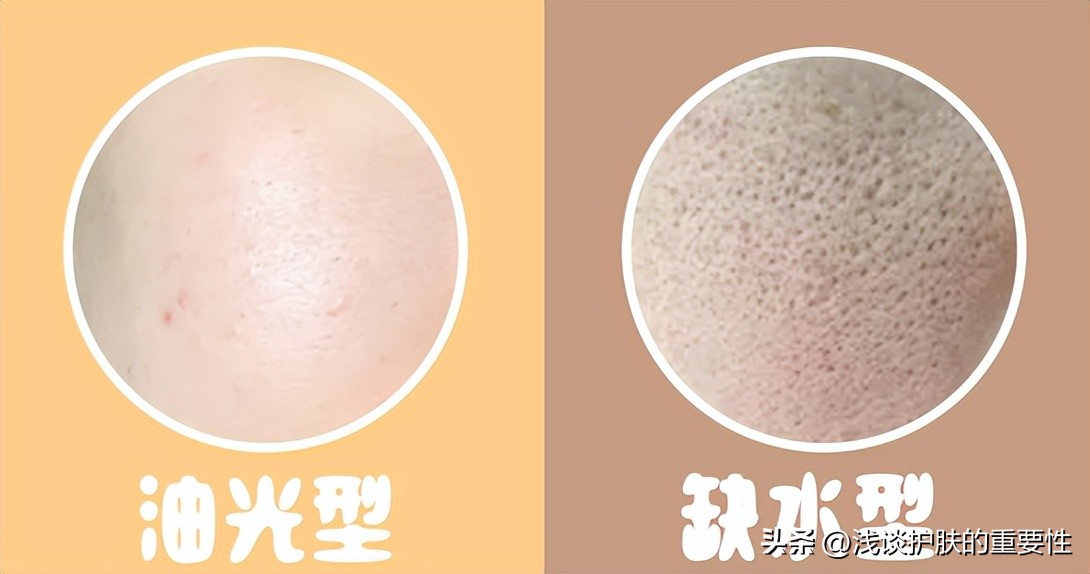 小方法解决毛孔粗大问题,佰花方能收缩毛孔吗