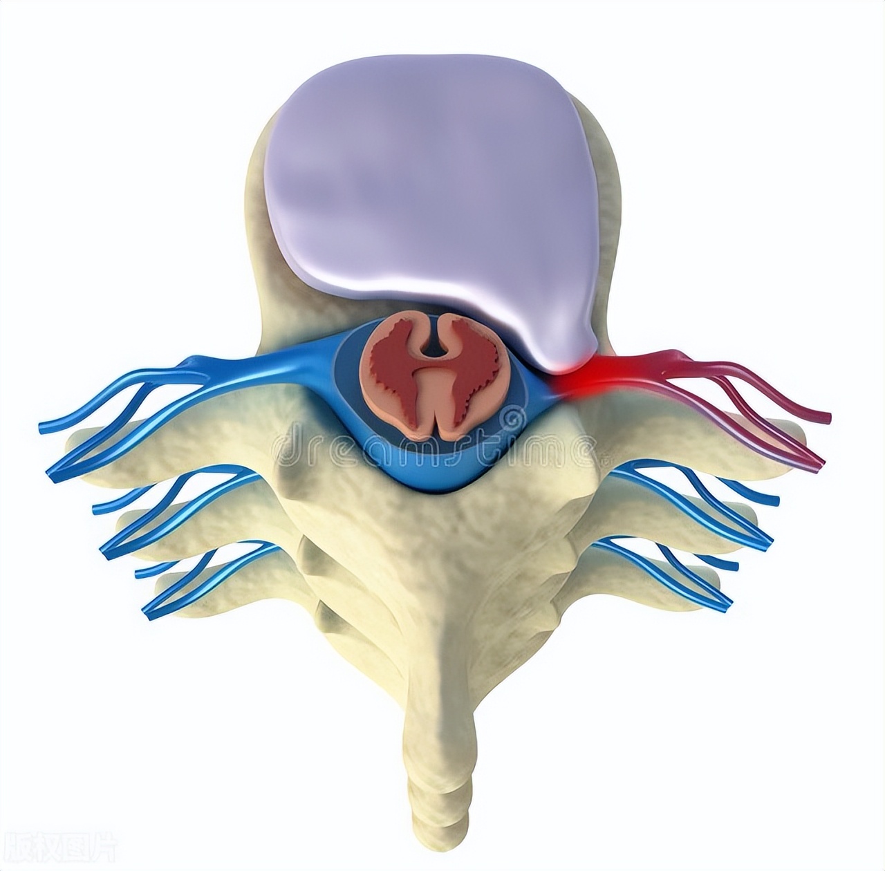 腰5椎体向前滑脱并椎弓断裂,报告腰5椎体骶化什么意思