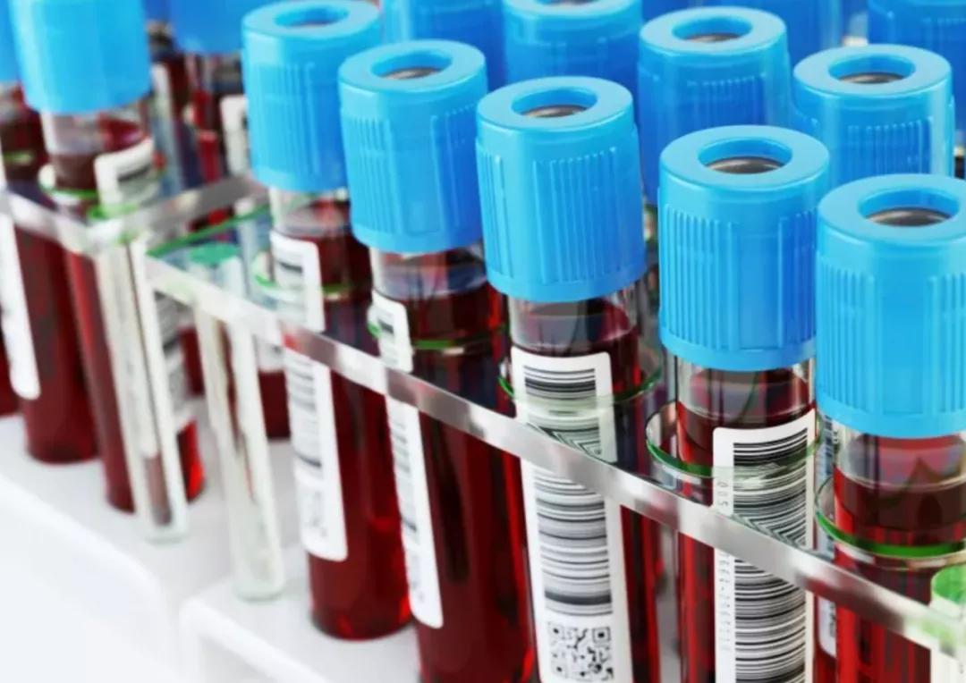 美国输往全球的血，竟然是这些人偷偷捐的？